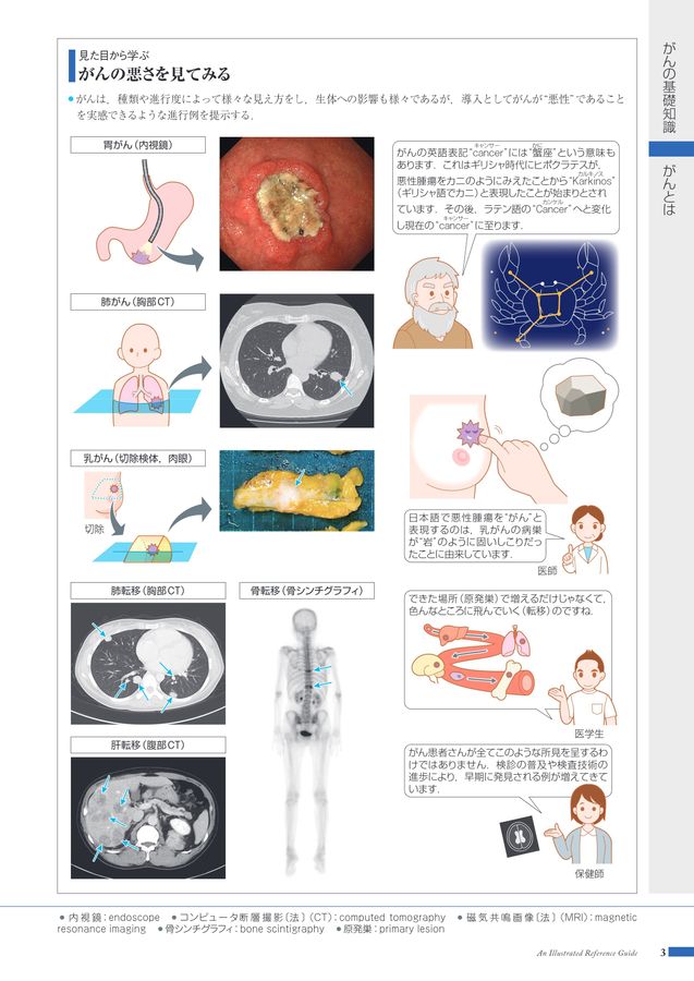 Reference Chart - Understanding Breast Cancer 