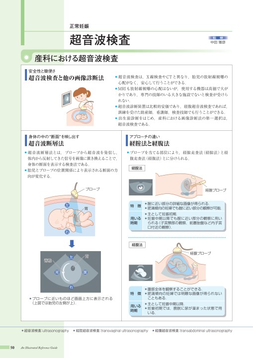 ノン ストレス テスト と は