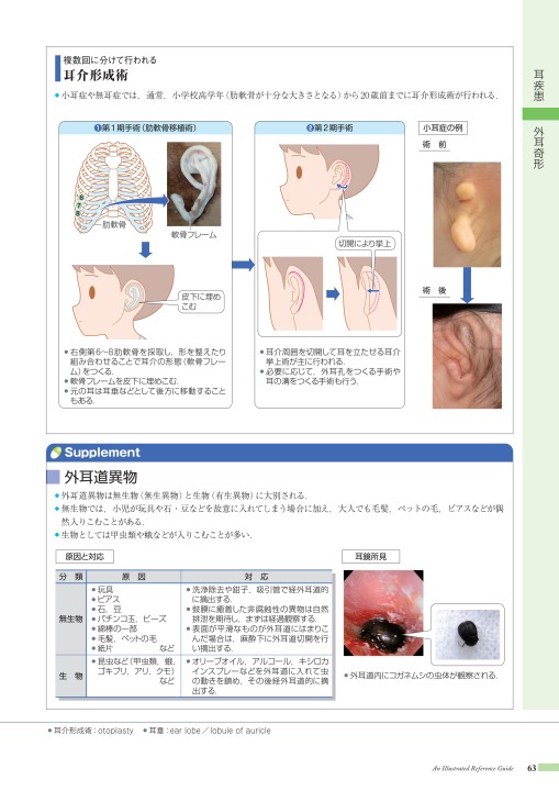 病13-1版_web立ち読み_201201