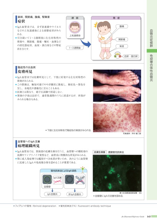 Amazon.co.jp: 皮膚血管炎 第2版 : 川名 誠司, 陳 科榮: 本