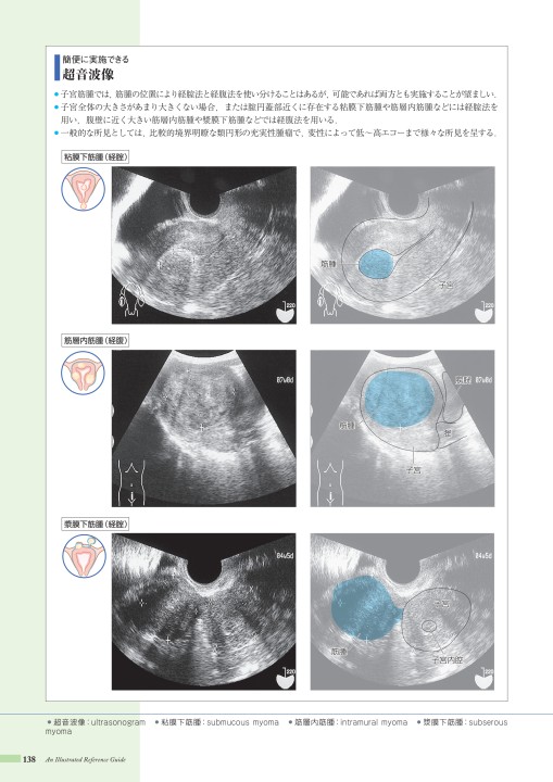 病9 4版 立ち読み