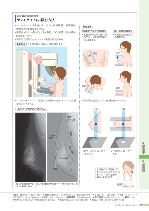 知っているようで知らない マンモグラフィーの基礎②