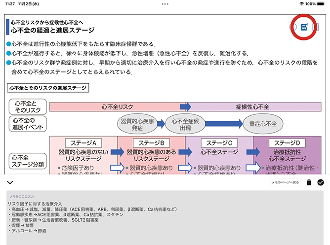 メモ