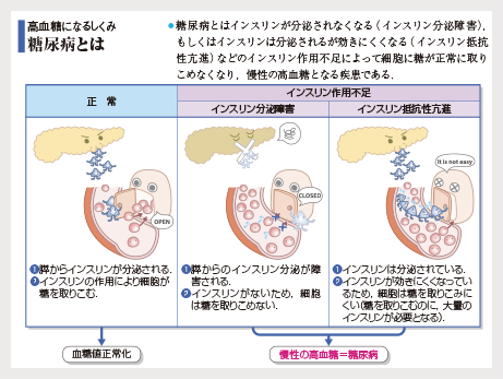 工夫されたイラスト