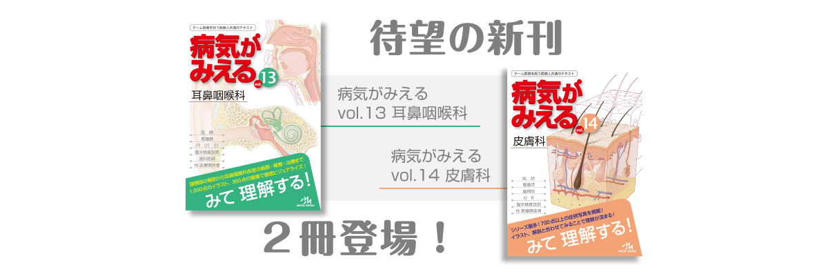 が みえる 病気 物がゆがんで見える…加齢黄斑変性かも?