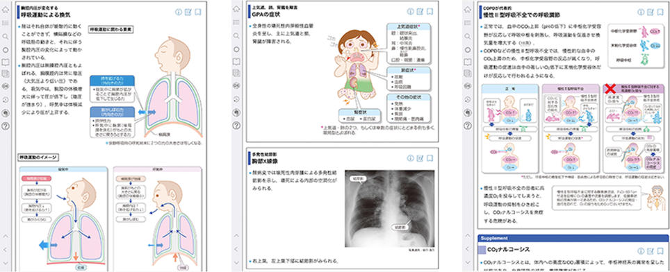 病気がみえる vol.4 呼吸器