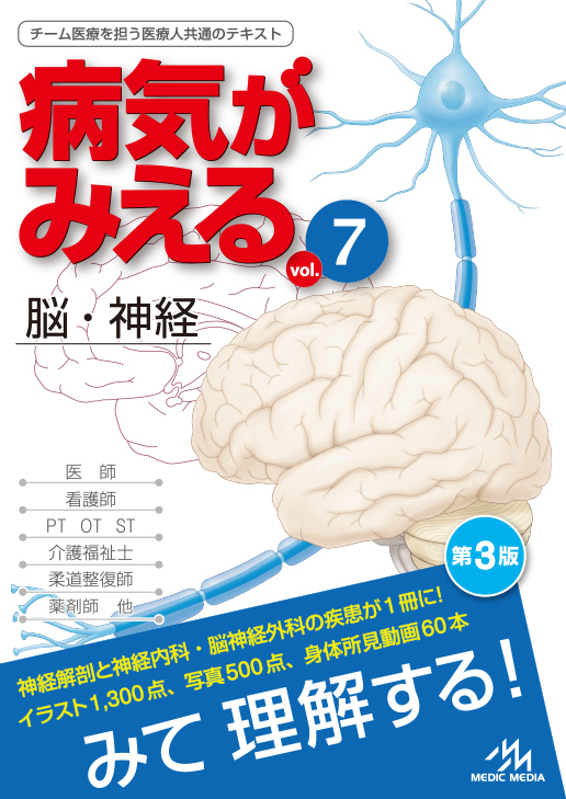 病気がみえる vol.7 脳・神経
