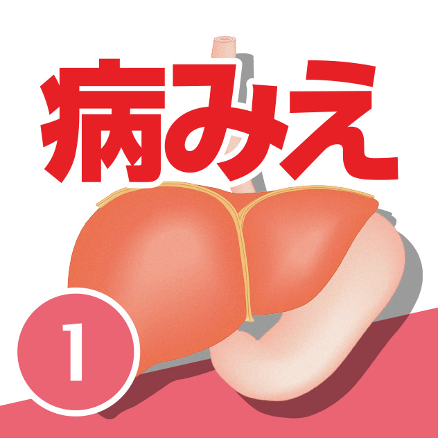 病気がみえる vol.1 消化器