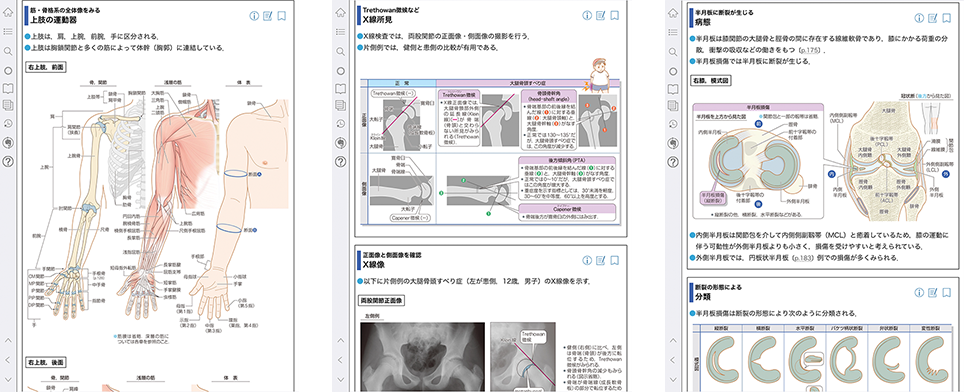 病気がみえる vol.11 運動器・整形外科