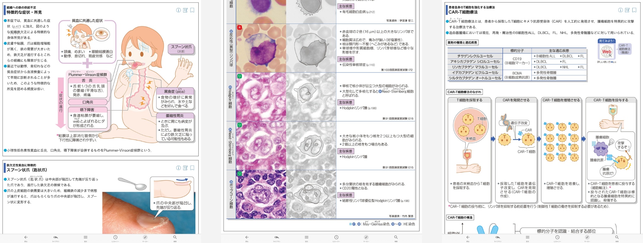 病気がみえる vol.5 血液