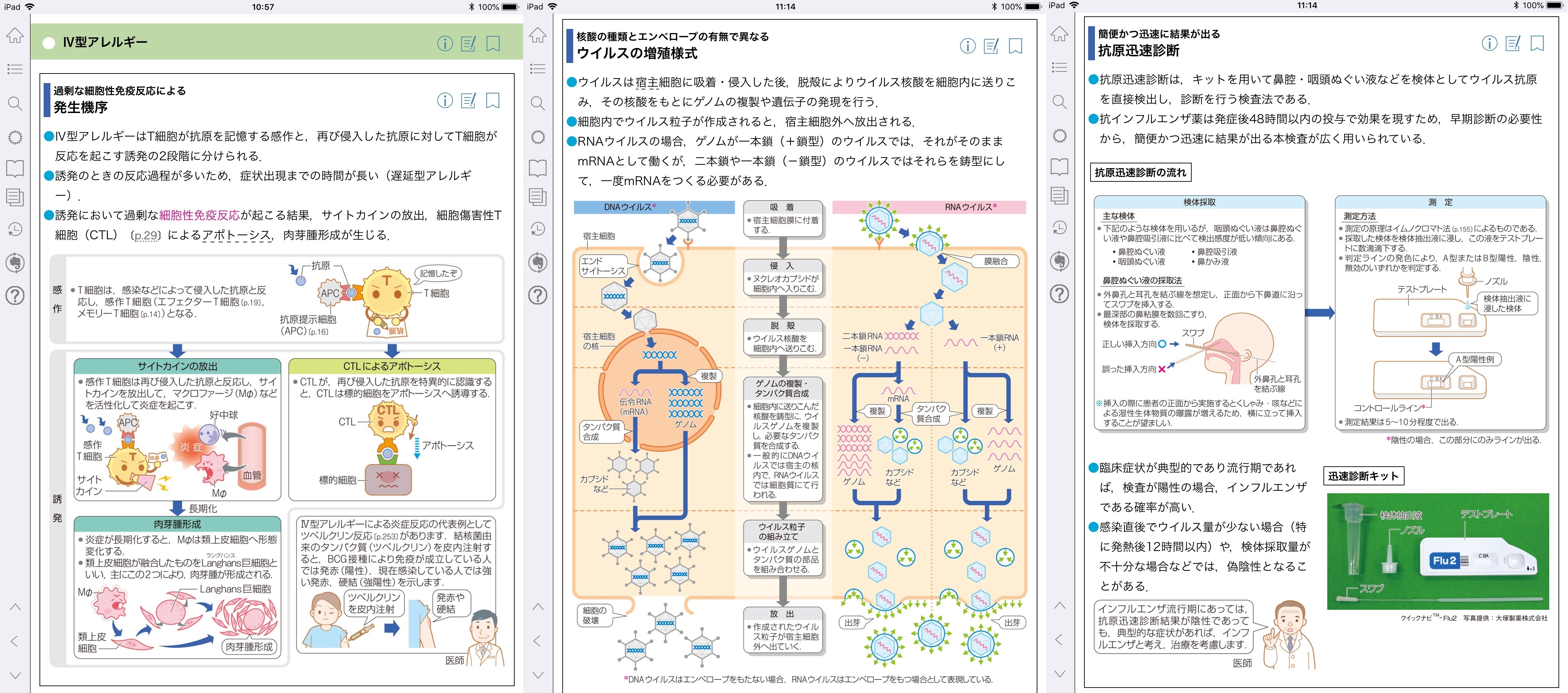 病気がみえる vol.6 免疫・膠原病・感染症