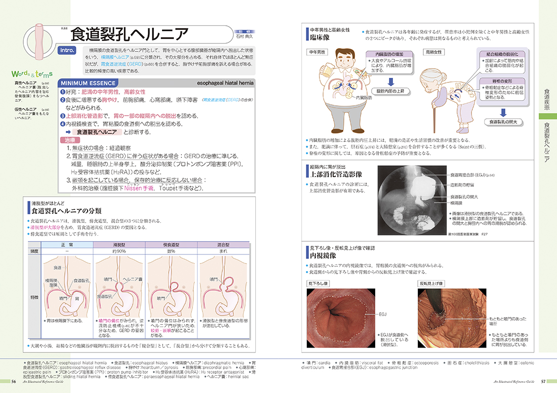 病気がみえる １ 第４版