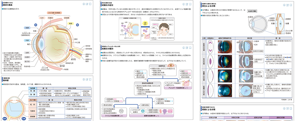 病気がみえる vol.12 眼科