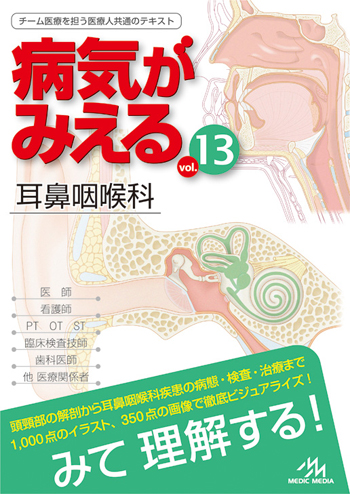 病気がみえる Vol 13 耳鼻咽喉科 チーム医療を担う医療人共通のテキスト 病気がみえる 公式サイト