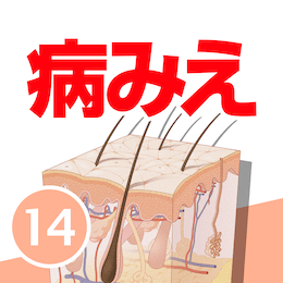 病気がみえる vol.14 皮膚科