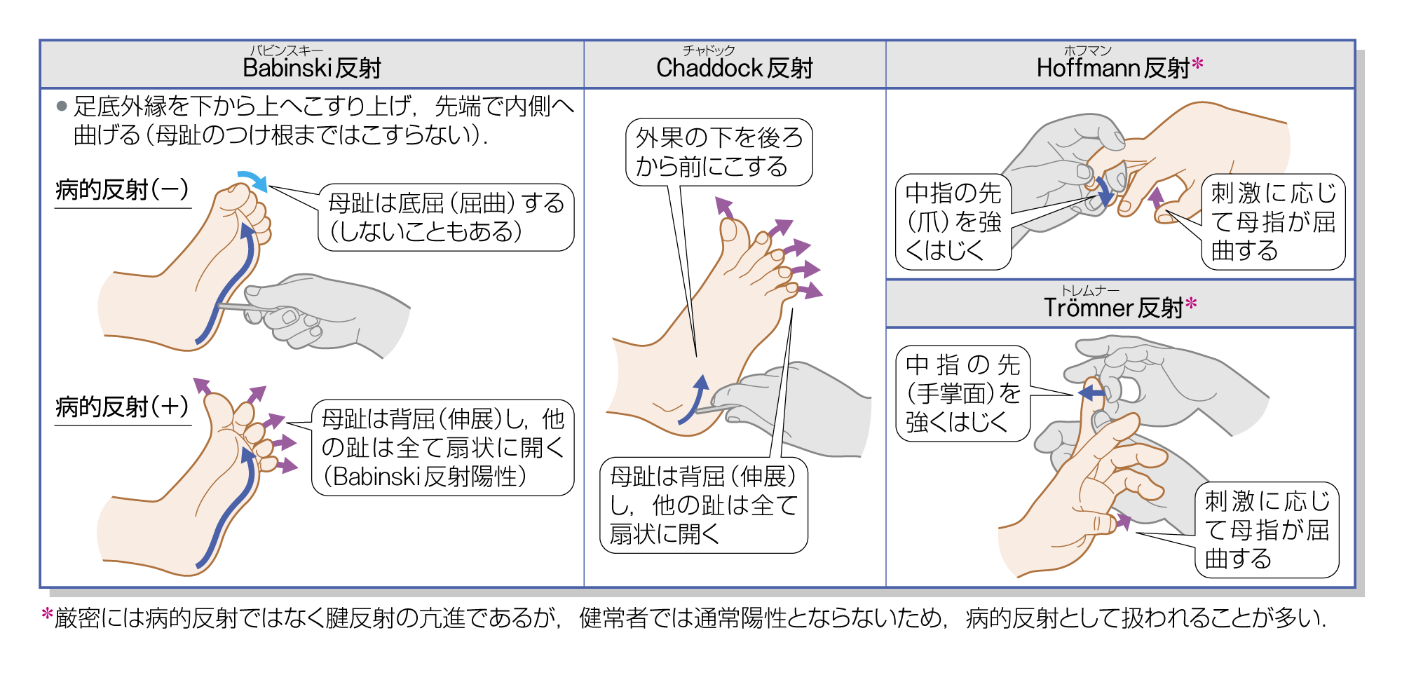 After image