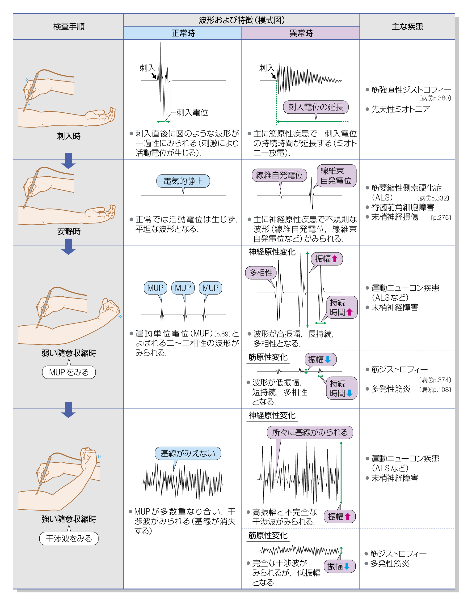 After image