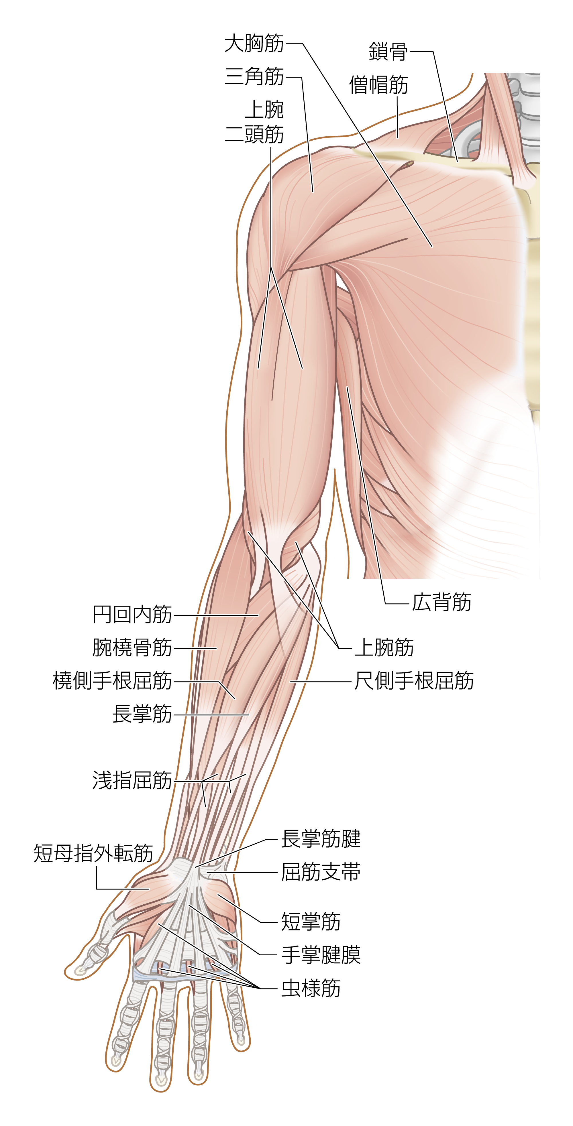 After image