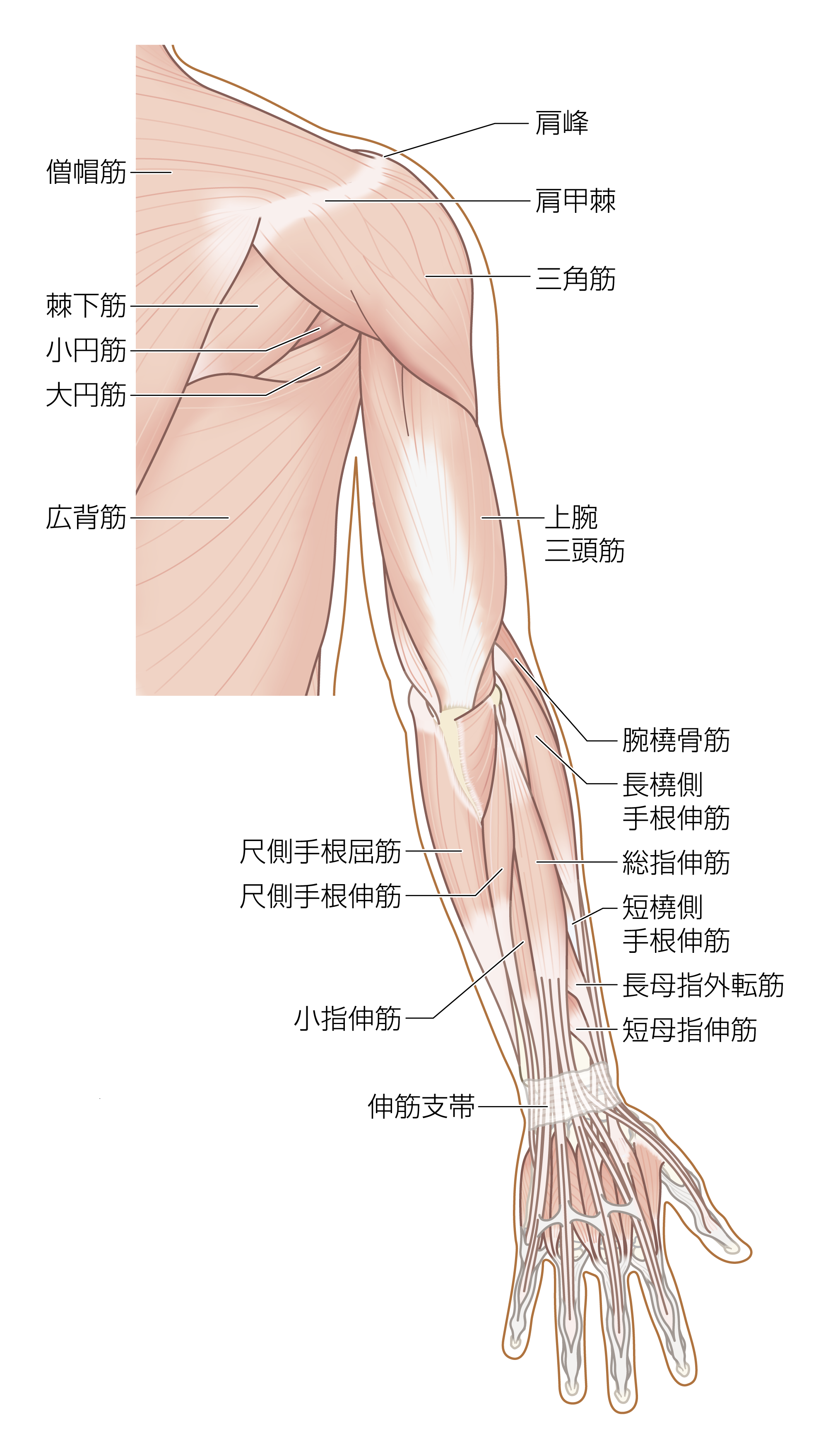 After image