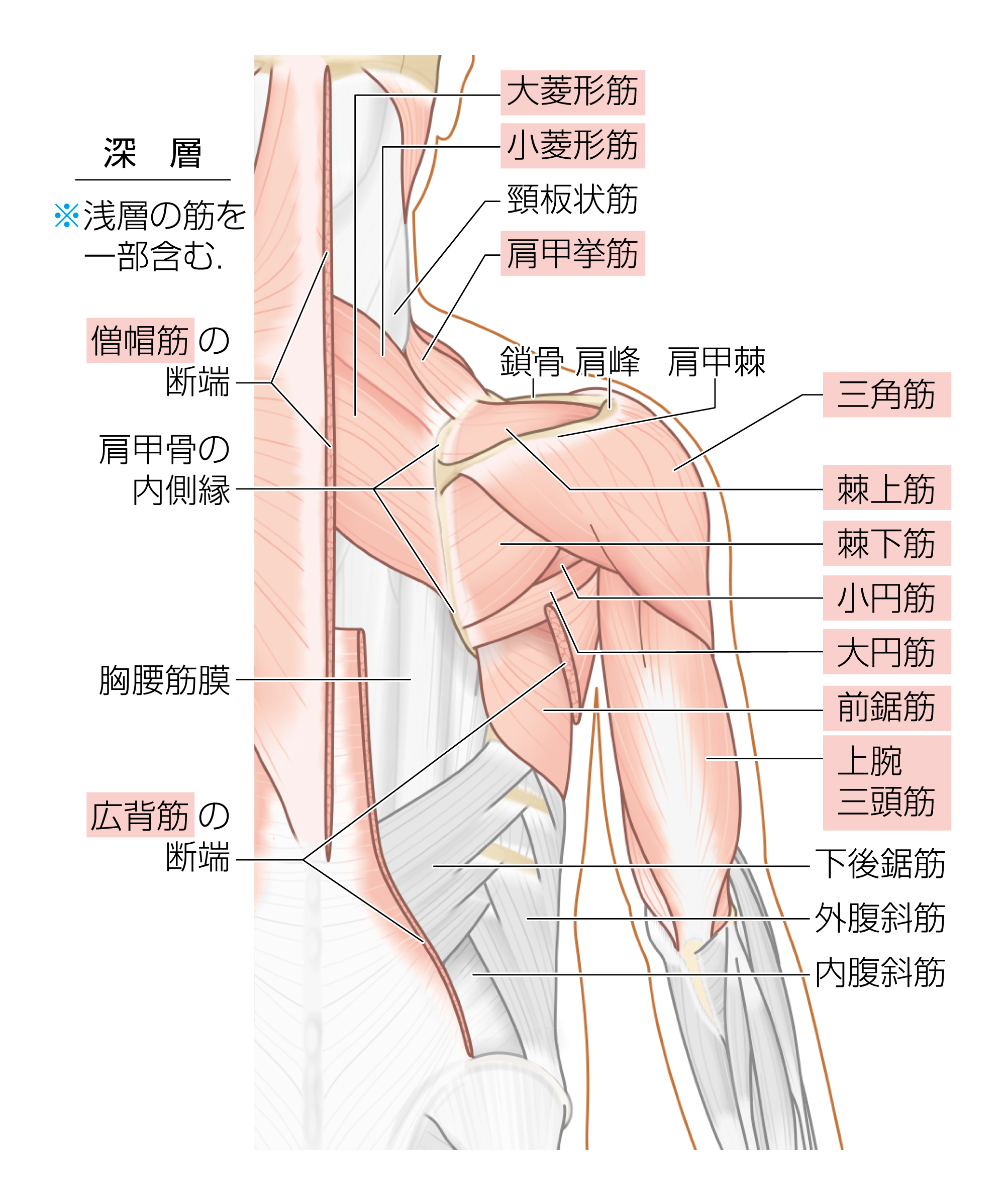 After image