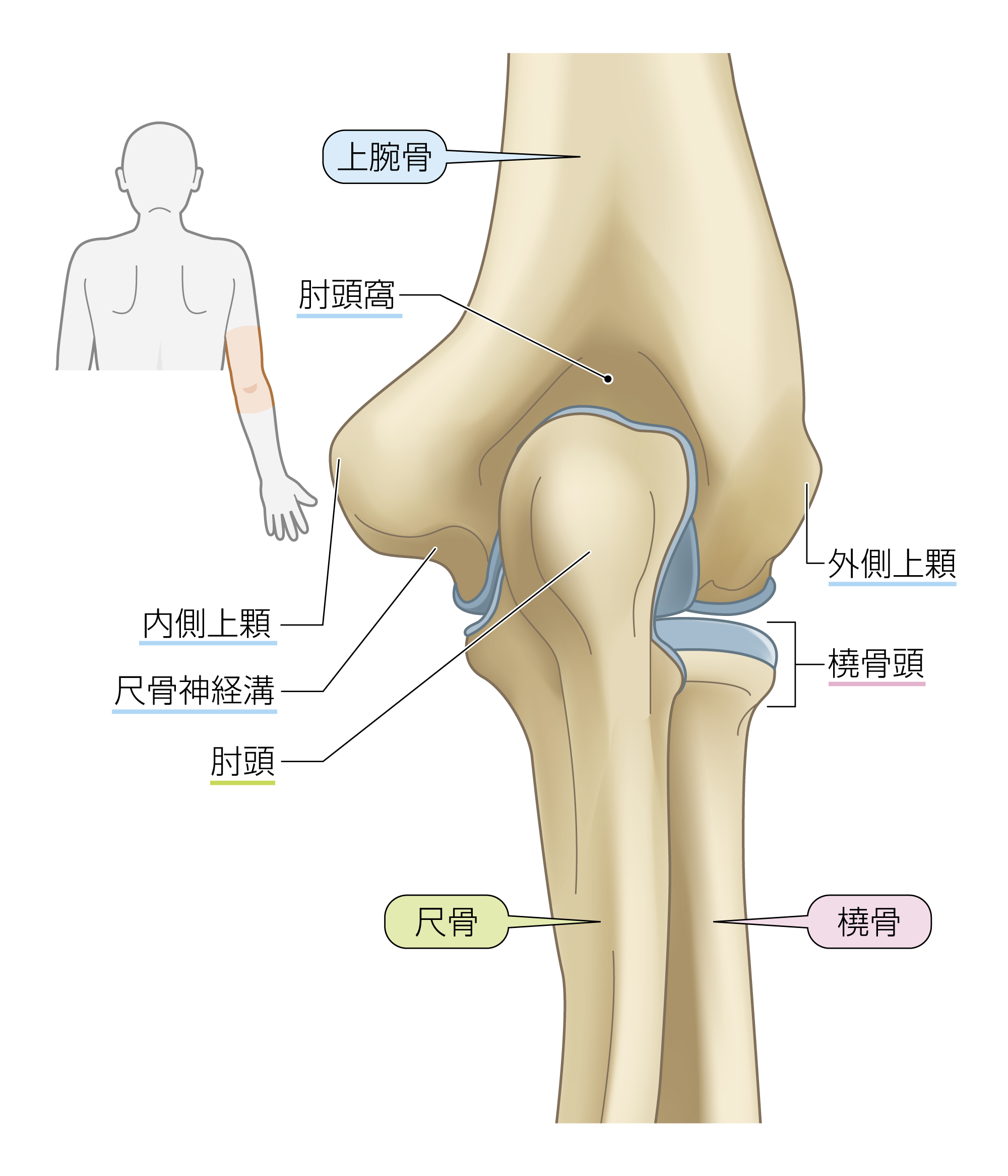 After image