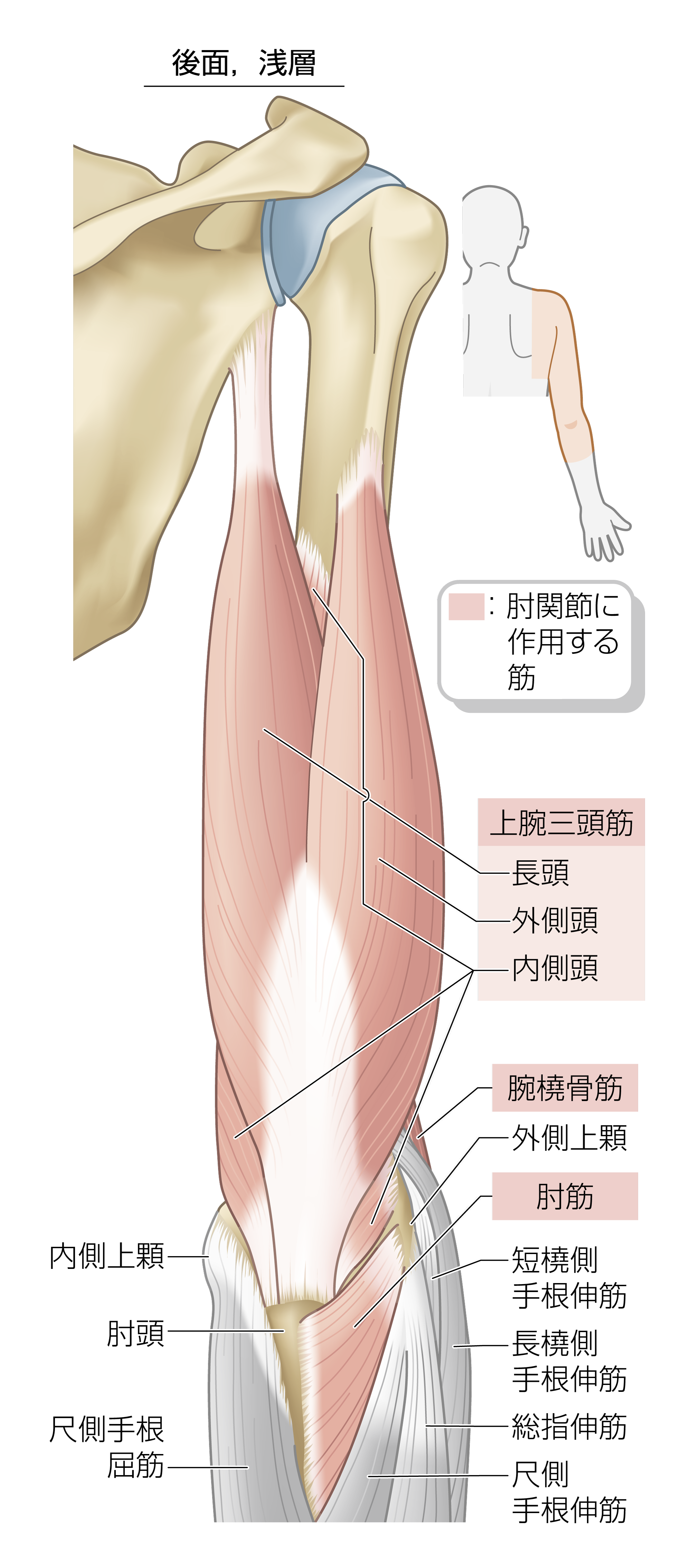After image