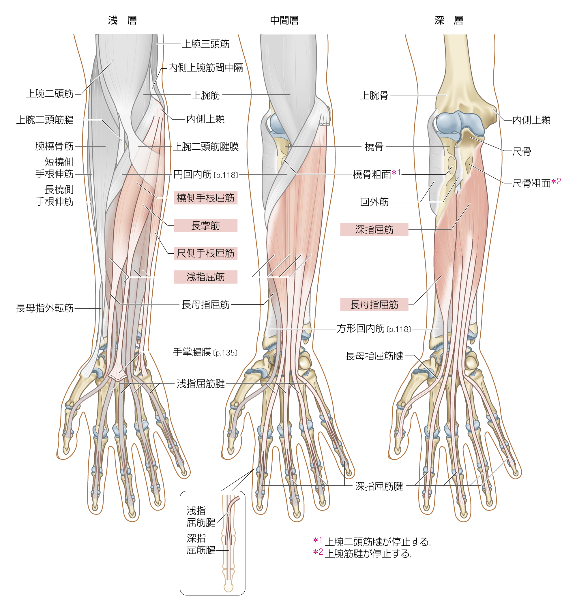 After image