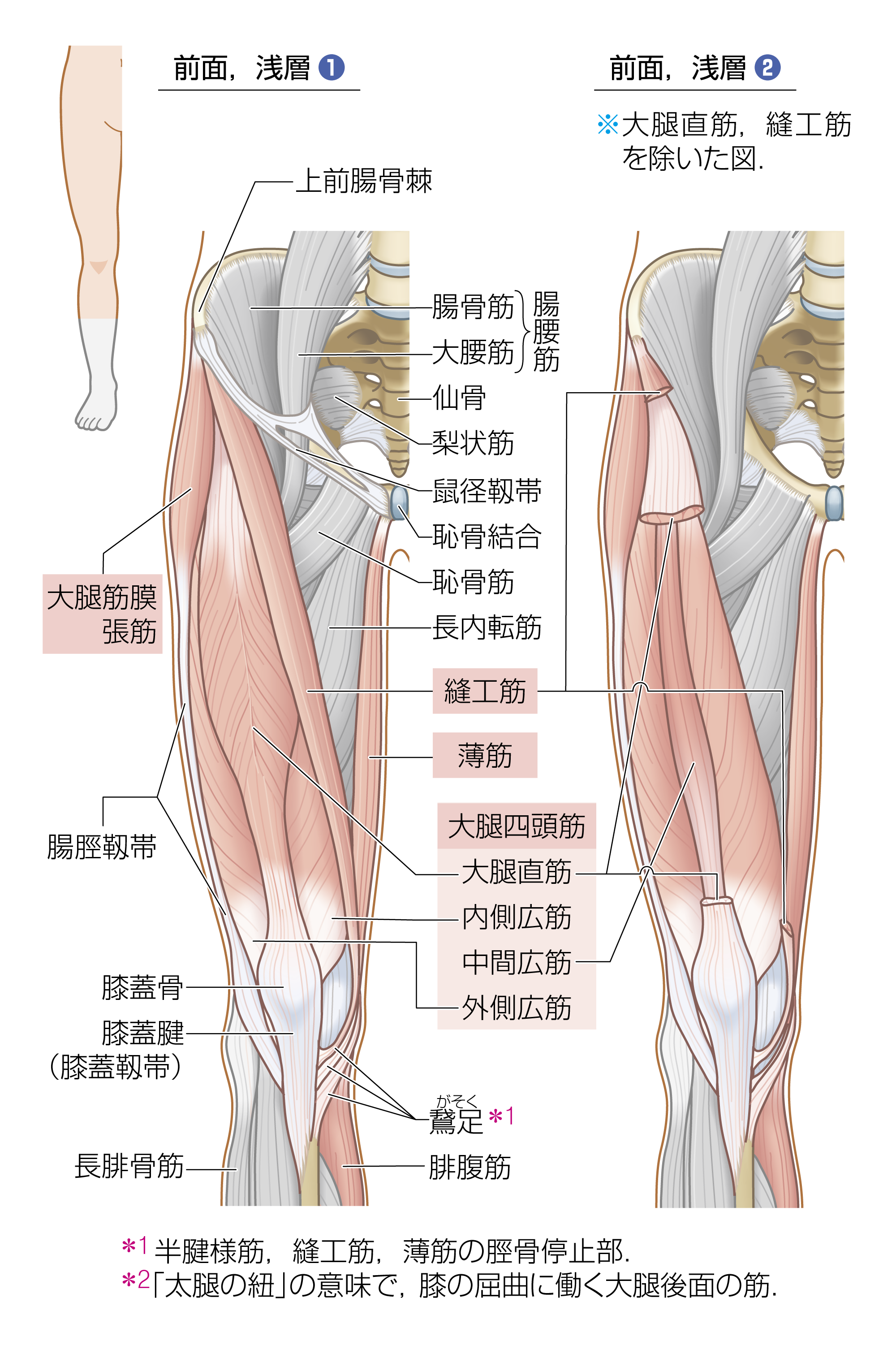 After image