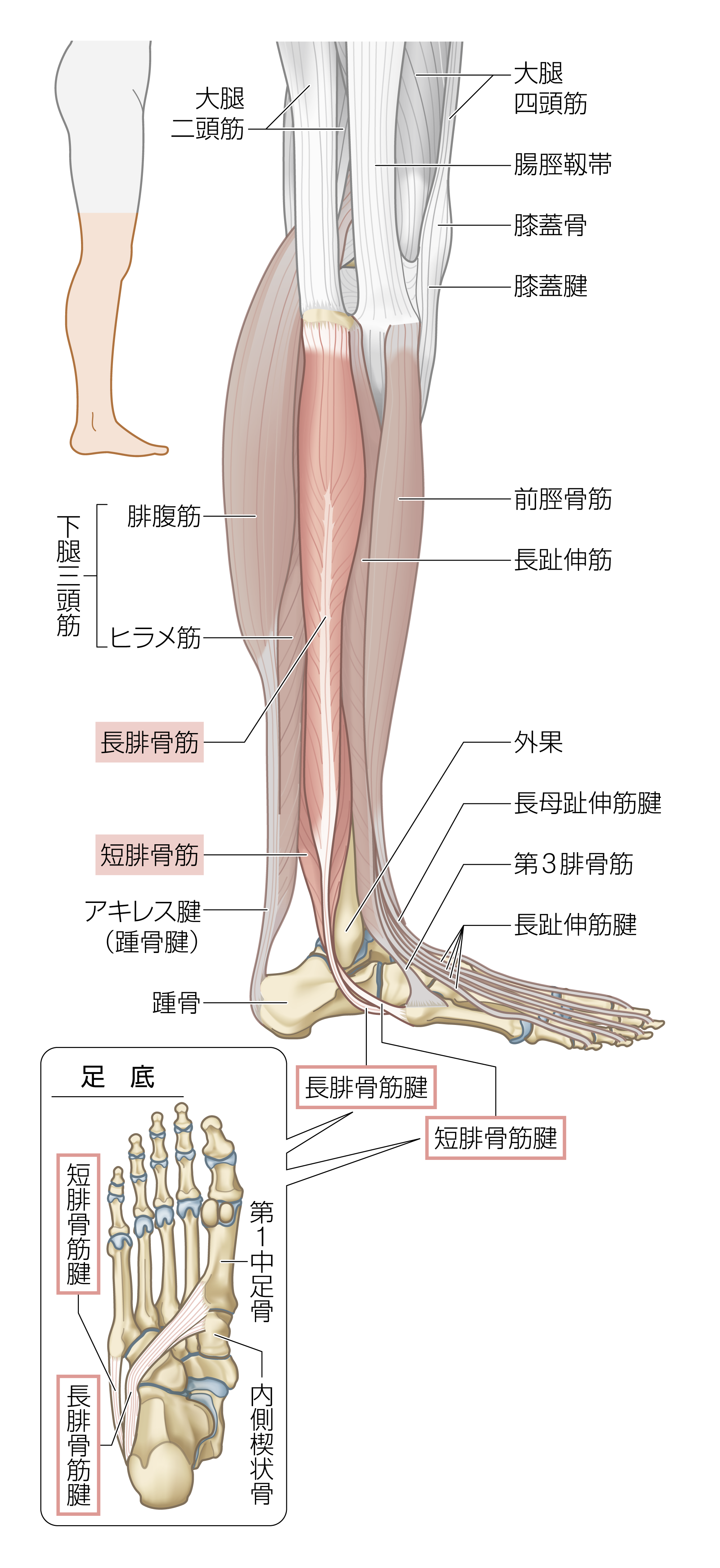 After image