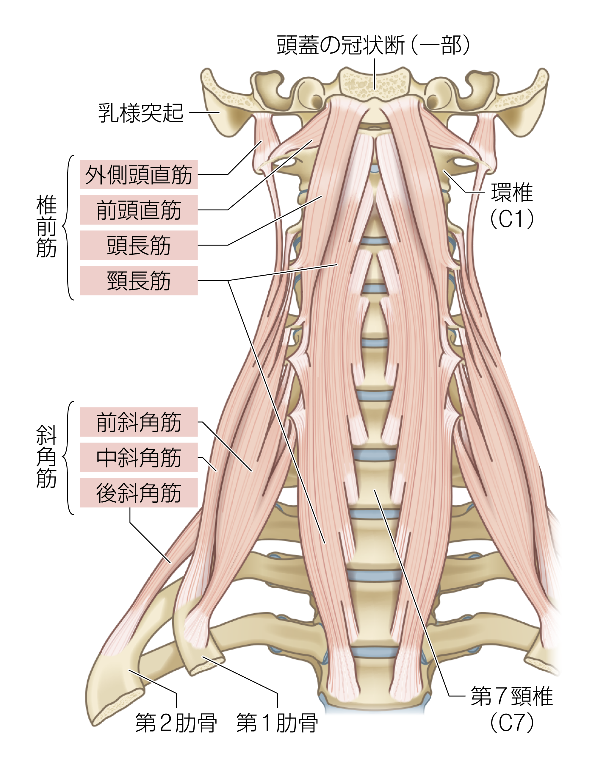 After image