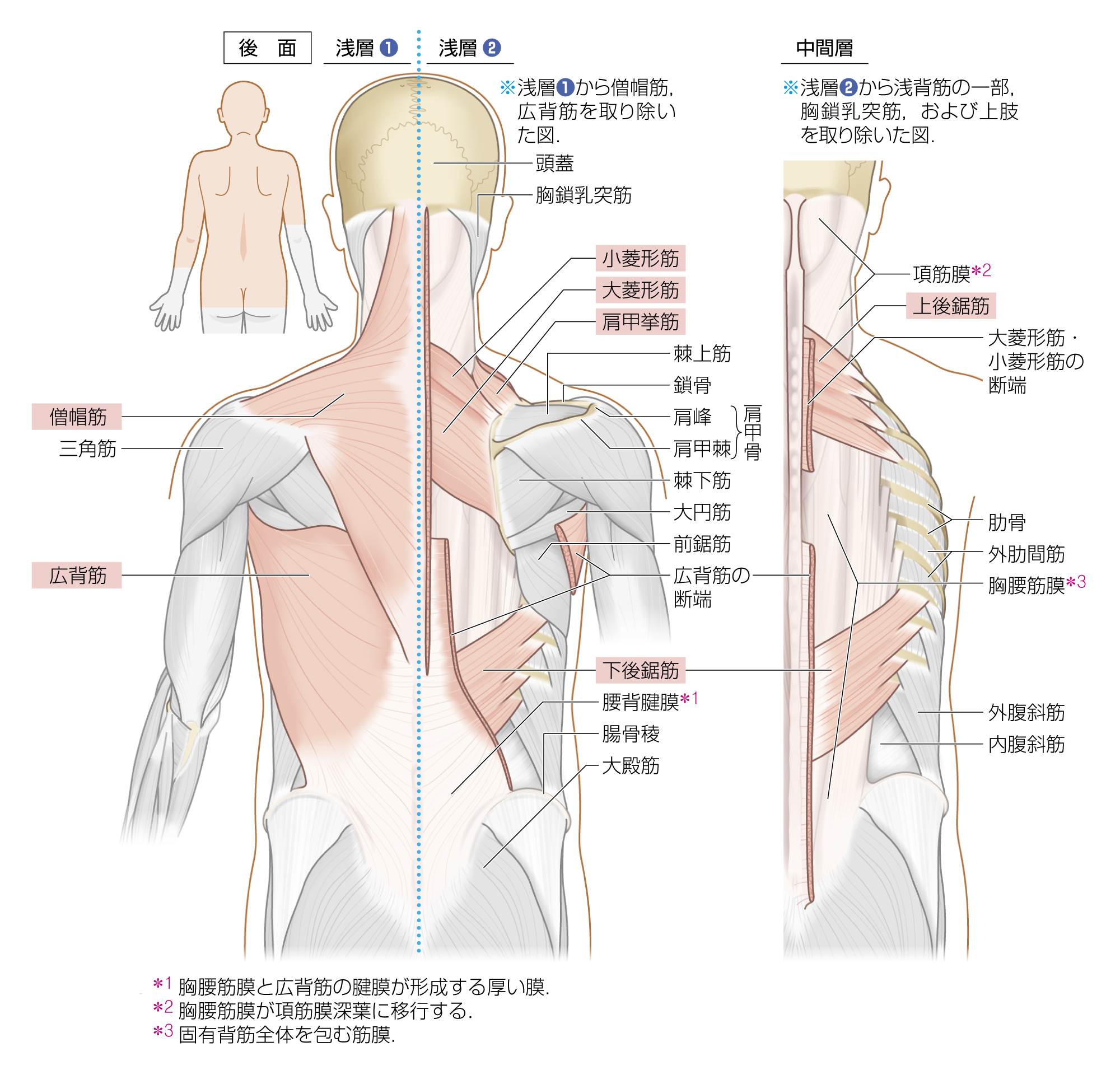 After image