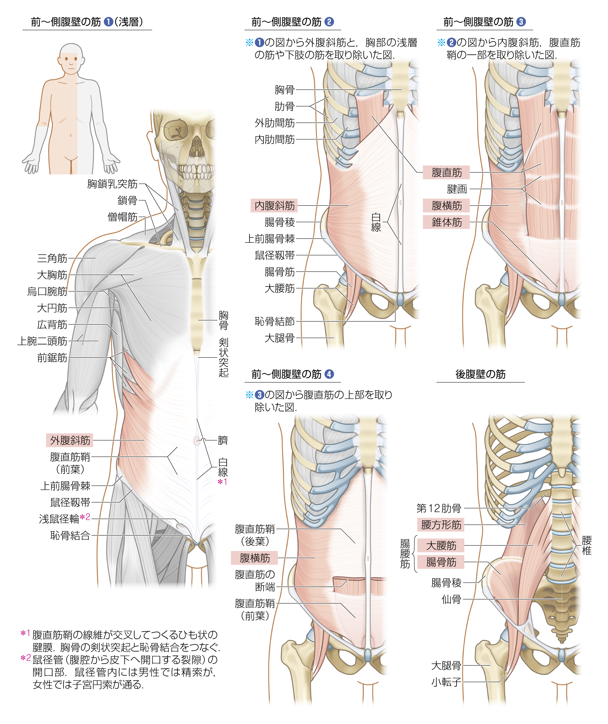 After image